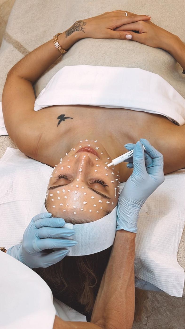 Treatment at Skin HQ